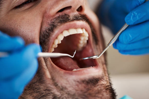 Best Tooth Extraction  in Shandon, CA